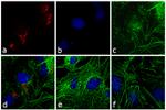 Rabbit IgG (H+L) Secondary Antibody in Immunocytochemistry (ICC/IF)