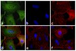 Rat IgG (H+L) Secondary Antibody in Immunocytochemistry (ICC/IF)