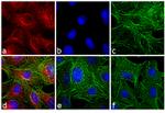 Rat IgG (H+L) Highly Cross-Adsorbed Secondary Antibody in Immunocytochemistry (ICC/IF)