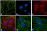 Rat IgG (H+L) Secondary Antibody in Immunocytochemistry (ICC/IF)