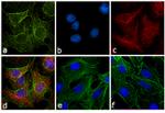 Rat IgG (H+L) Cross-Adsorbed Secondary Antibody in Immunocytochemistry (ICC/IF)