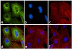 Rat IgG (H+L) Secondary Antibody in Immunocytochemistry (ICC/IF)