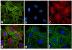 Rat IgG (H+L) Secondary Antibody in Immunocytochemistry (ICC/IF)