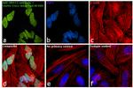 Mouse IgG2a Cross-Adsorbed Secondary Antibody in Immunocytochemistry (ICC/IF)