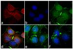 Mouse IgG2a Cross-Adsorbed Secondary Antibody in Immunocytochemistry (ICC/IF)