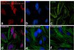 Mouse IgG2a Cross-Adsorbed Secondary Antibody in Immunocytochemistry (ICC/IF)