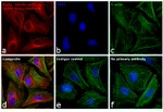 Mouse IgG (H+L) Cross-Adsorbed Secondary Antibody in Immunocytochemistry (ICC/IF)