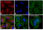 Mouse IgG (H+L) Highly Cross-Adsorbed Secondary Antibody in Immunocytochemistry (ICC/IF)