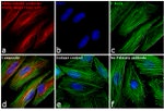 Mouse IgG (H+L) Cross-Adsorbed Secondary Antibody in Immunocytochemistry (ICC/IF)