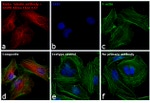 Rabbit IgG (H+L) Cross-Adsorbed Secondary Antibody in Immunocytochemistry (ICC/IF)