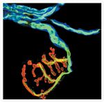 Rabbit IgG (H+L) Cross-Adsorbed Secondary Antibody in Immunocytochemistry (ICC/IF)