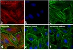 Rat IgG (H+L) Cross-Adsorbed Secondary Antibody in Immunocytochemistry (ICC/IF)