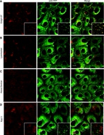 Golgin-97 Antibody in Immunocytochemistry (ICC/IF)