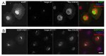 Golgin-97 Antibody in Immunohistochemistry (IHC)