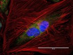 Golgin-97 Antibody in Immunocytochemistry (ICC/IF)