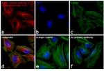 Mouse IgG (H+L) Cross-Adsorbed Secondary Antibody in Immunocytochemistry (ICC/IF)