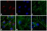 Rabbit IgG (H+L) Cross-Adsorbed Secondary Antibody in Immunocytochemistry (ICC/IF)