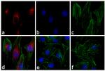 Rabbit IgG (H+L) Cross-Adsorbed Secondary Antibody in Immunocytochemistry (ICC/IF)