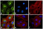 Rat IgG (H+L) Cross-Adsorbed Secondary Antibody in Immunocytochemistry (ICC/IF)