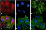 Rat IgG (H+L) Cross-Adsorbed Secondary Antibody in Immunocytochemistry (ICC/IF)