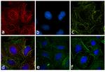 Rat IgG (H+L) Cross-Adsorbed Secondary Antibody in Immunocytochemistry (ICC/IF)