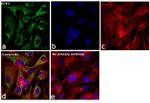 ECH1 Antibody in Immunocytochemistry (ICC/IF)