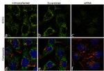 ECH1 Antibody in Immunocytochemistry (ICC/IF)