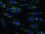 ECH1 Antibody in Immunocytochemistry (ICC/IF)