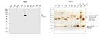 Human IgA Secondary Antibody in Western Blot (WB)