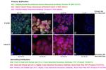 Human IgG (H+L) Cross-Adsorbed Secondary Antibody in Immunocytochemistry (ICC/IF)