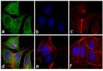 Mouse IgG (H+L) Secondary Antibody in Immunocytochemistry (ICC/IF)