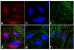 Mouse IgG (H+L) Highly Cross-Adsorbed Secondary Antibody in Immunocytochemistry (ICC/IF)