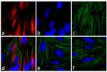 Mouse IgG (H+L) Cross-Adsorbed Secondary Antibody in Immunocytochemistry (ICC/IF)