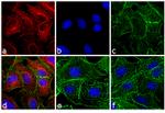 Rat IgG (H+L) Cross-Adsorbed Secondary Antibody in Immunocytochemistry (ICC/IF)