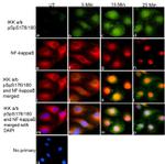 Rabbit IgG (Heavy chain) Secondary Antibody in Immunocytochemistry (ICC/IF)