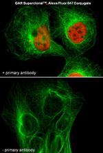 Mouse IgG (H+L) Secondary Antibody in Immunocytochemistry (ICC/IF)