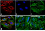 Mouse IgG (H+L) Secondary Antibody in Immunocytochemistry (ICC/IF)