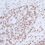 USP7 Antibody in Immunohistochemistry (Paraffin) (IHC (P))