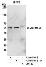 Aurora A Antibody in Immunoprecipitation (IP)