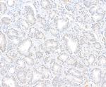 Menin Antibody in Immunohistochemistry (Paraffin) (IHC (P))