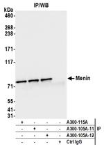 Menin Antibody in Immunoprecipitation (IP)