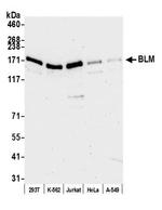 BLM Antibody in Western Blot (WB)