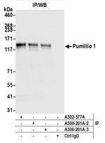 Pumilio 1 Antibody in Immunoprecipitation (IP)