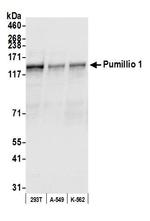 Pumilio 1 Antibody in Western Blot (WB)