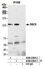 SMC5 Antibody in Immunoprecipitation (IP)