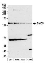 SMC5 Antibody in Western Blot (WB)