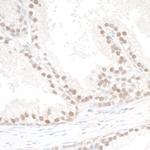 SMC6 Antibody in Immunohistochemistry (Paraffin) (IHC (P))