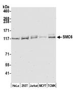 SMC6 Antibody in Western Blot (WB)