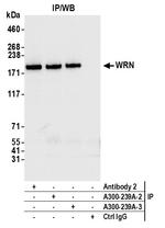 WRN Antibody in Immunoprecipitation (IP)