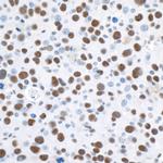 53BP1 Antibody in Immunohistochemistry (Paraffin) (IHC (P))